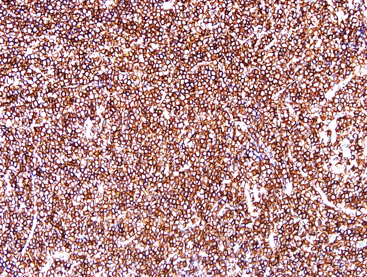 CD43